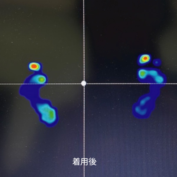 着用後 足底圧