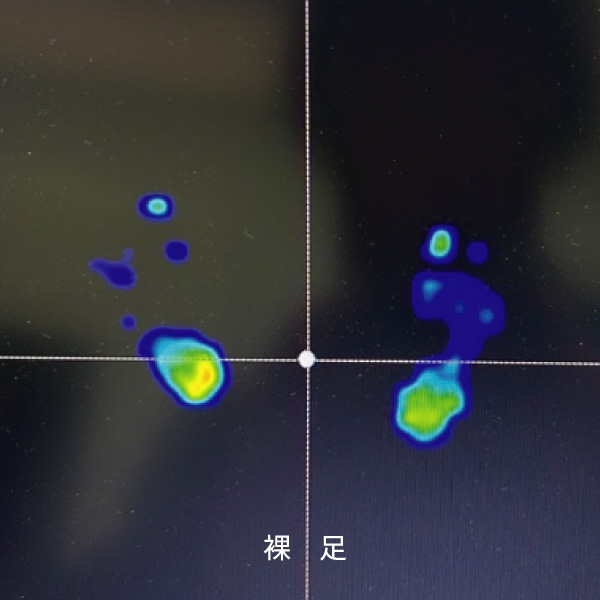 裸足 足底圧